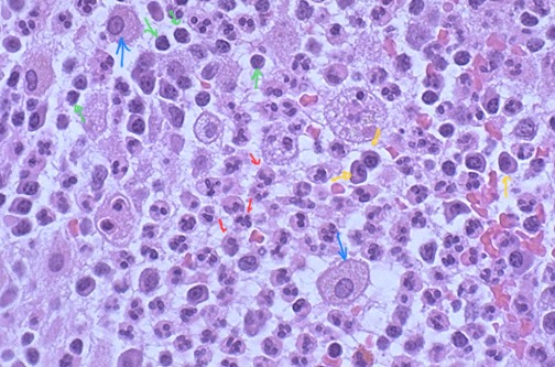 <ol><li><p>ID Pathology</p></li><li><p>Identify red, blue, yellow, and green pointed structures</p></li><li><p>Describe process the encircled cell is undergoing</p></li></ol>