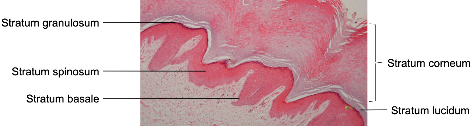 <p>Thick skin: Strata of epidermis</p>