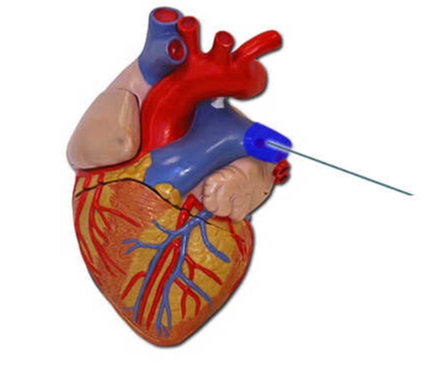 <p>left pulmonary artery</p>