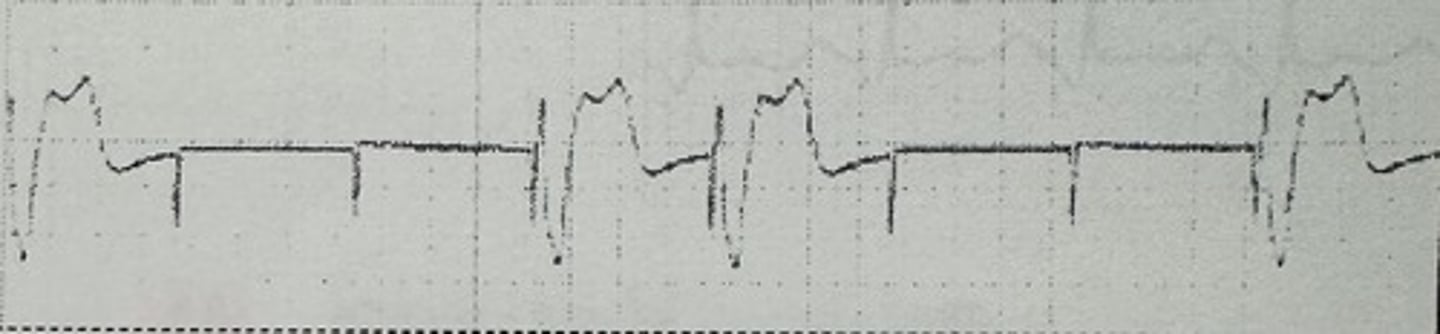 <p>identify the rhythm</p>