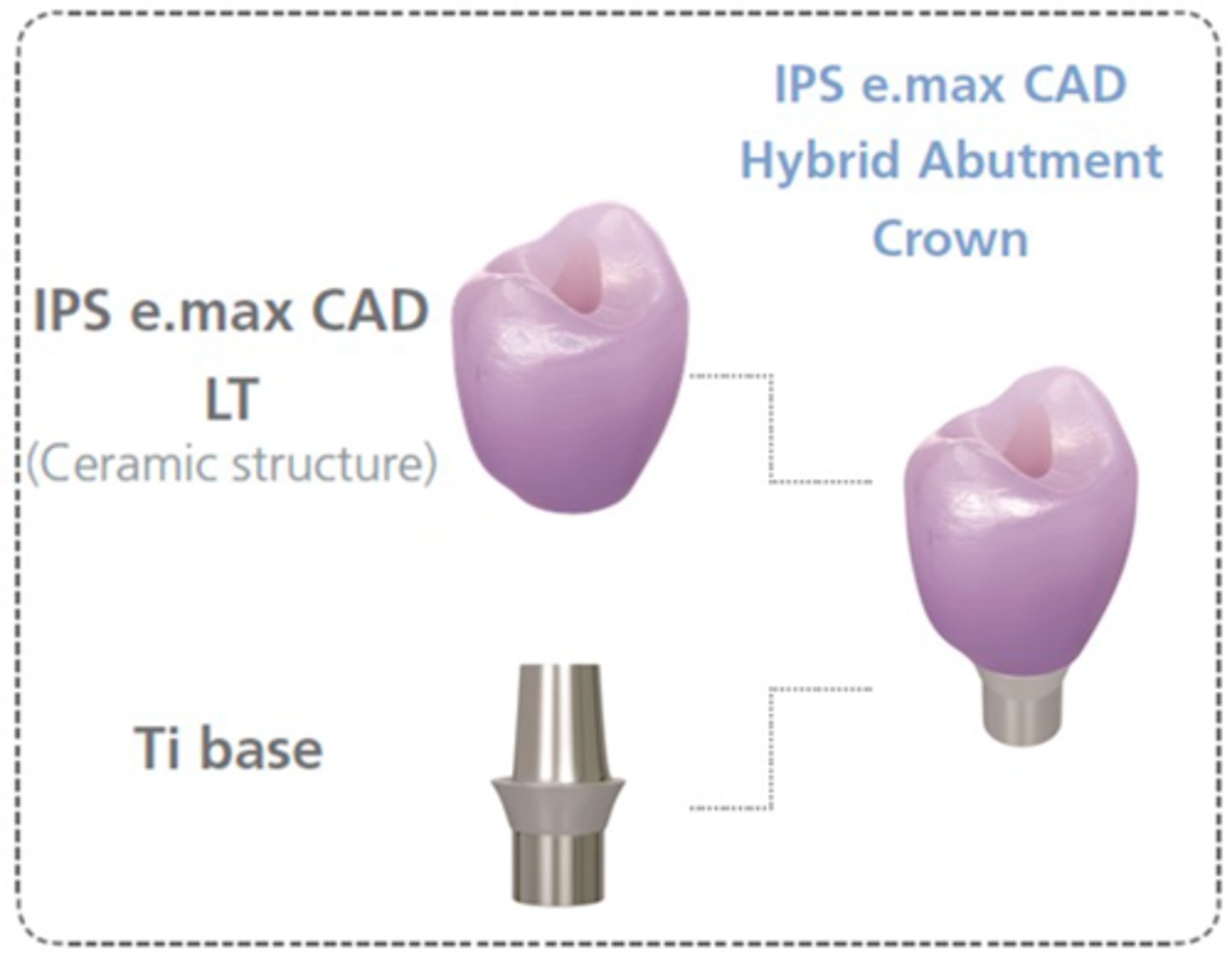<p>• combines abutment and</p><p>monolithic crown in one piece</p><p>• an efficient two-in-one solution</p><p>made of lithium disilicate or</p><p>zirconia which is directly luted to</p><p>a Ti base</p><p>• Good for non-esthetic areas for</p><p>patients who do not exhibit</p><p>parafunctional activity</p>