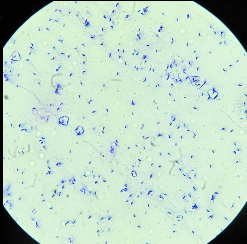 <p><span data-name="microscope" data-type="emoji">🔬</span><span data-name="petri_dish" data-type="emoji">🧫</span><strong><span> </span>Na podstawie zdjęcia preparatu:</strong></p><p></p><ul><li><p><span>📖 </span>rozpoznaj gatunek pasożyta;</p></li></ul><p></p><ul><li><p><span>♻ </span>rozpoznaj wszystkie formy rozwojowe;</p></li></ul><p></p><ul><li><p><span>🦠 </span>wskaż organelle i cechy charakterystyczne dla danego gatunku;</p></li></ul><p></p><ul><li><p><span>😷 </span>nazwij chorobę, którą pasożyt wywołuje.</p></li></ul><p></p>