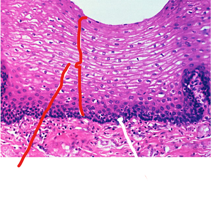 <p>Stratified Squamous Layer</p>