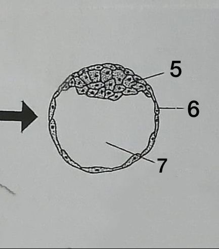 <ol start="5"><li><p>Masa interna de células</p></li><li><p>Trofoblasto</p></li><li><p>Blastocele</p></li></ol>