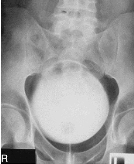 <p><span>What contrast procedure was performed to produce this image?</span></p>