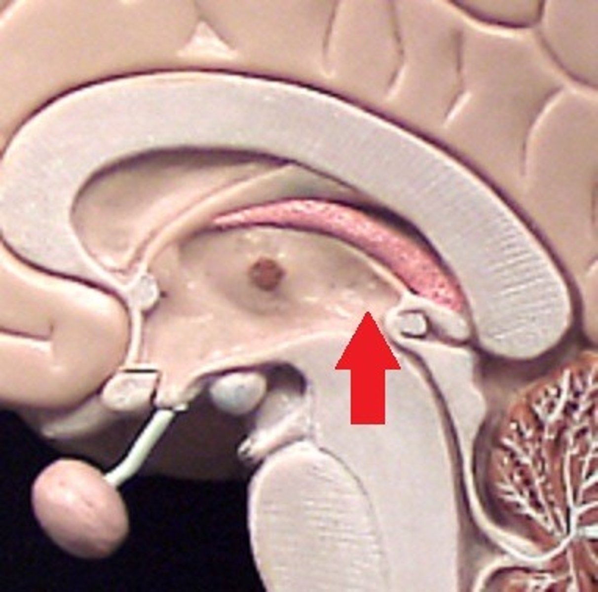<p>lines the thalamus</p>