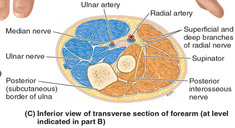 <p>Forearm Compartment Syndrome presents w/ the 5 ps</p>