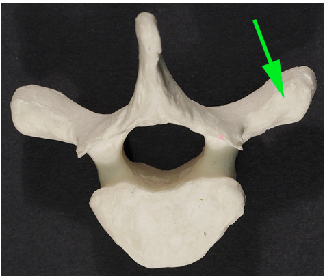 <p>What part of the vertebra is marked by the green arrow?</p>