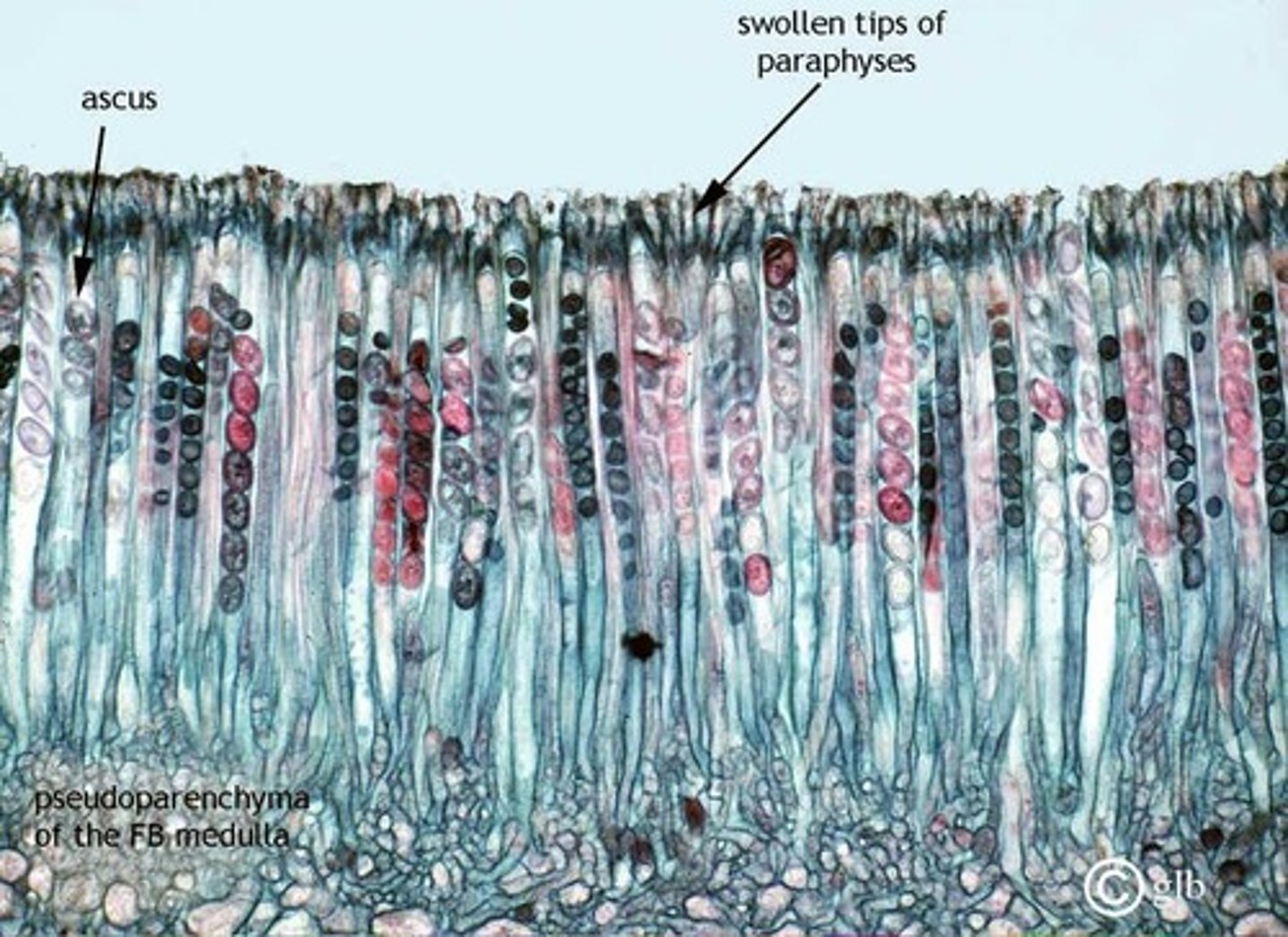 <p>During sexual reproduction in a sac fungus ,an ascocarp is formed. The ascocarp interior is lined with "sac"-shaped asci. Each ascus produces eight ascospores.</p>