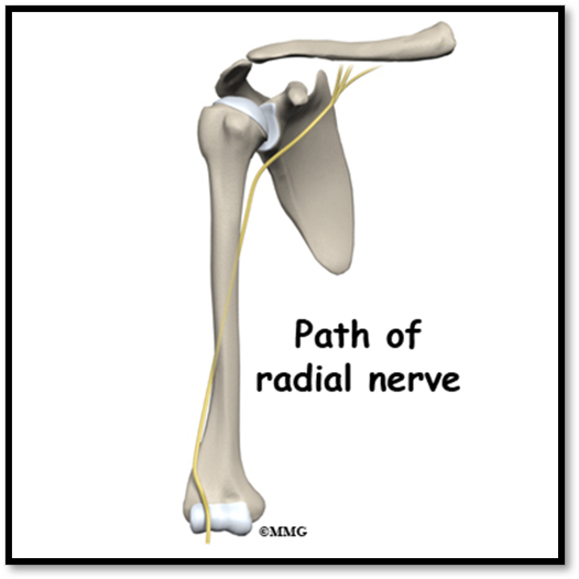 <p><span>•Common among young-middle age adults</span></p><p><span>•</span><strong><u><span>Sign/Symptoms: </span></u></strong><span>displacement of humerus shaft, shortened extremity, abnormal mobility, pain</span></p><p><span>•</span><strong><u><span>Complications: </span></u></strong><span>radial nerve injury, vascular injury to brachial artery</span></p><p><span>•</span><strong><u><span>Diagnostics: </span></u></strong><span>X-ray, CT</span></p><p><span>•</span><strong><u><span>Treatment: </span></u></strong><span>Hanging arm in cast, shoulder immobilizer, sling, PT</span></p><p><span>•</span><strong><u><span>Nursing: </span></u></strong><span>elevate HOB, allow arm to hang, prevent skin breakdown</span></p>