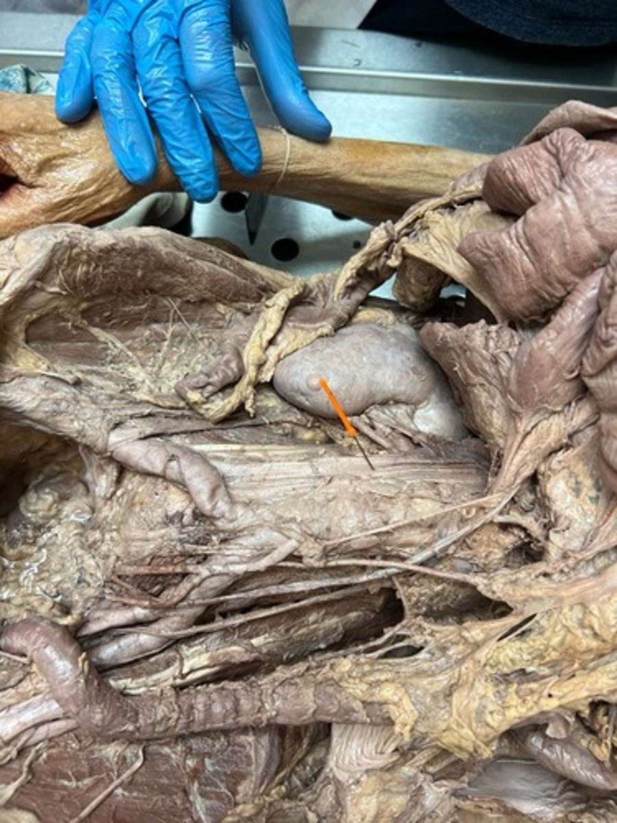 <p>inferior vena cava</p>