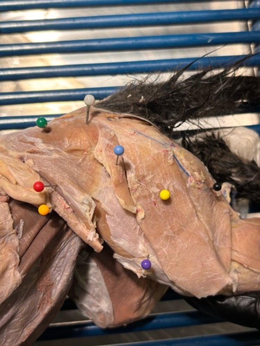 <p>What thigh muscle is the orange pin in</p>