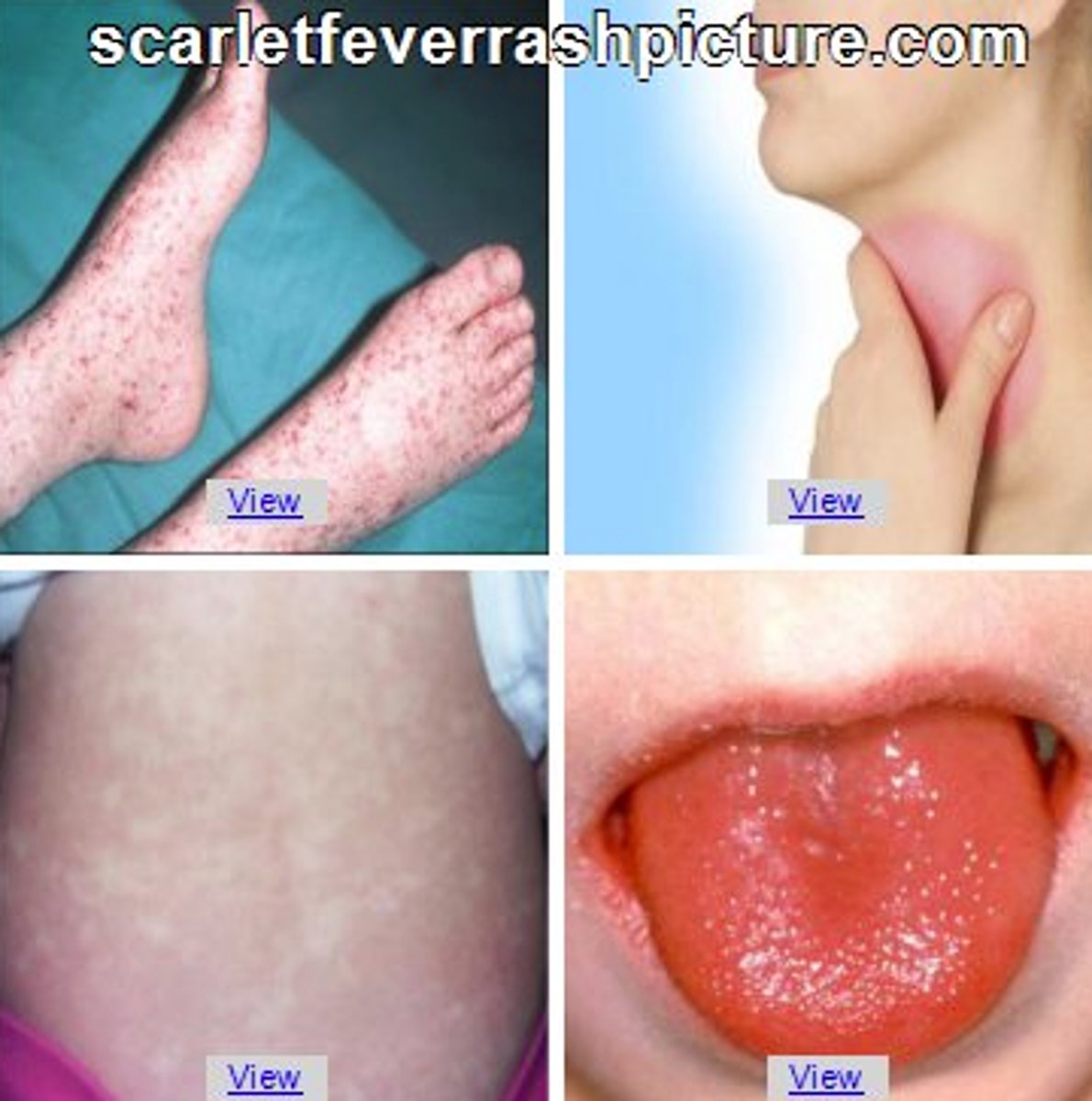 <p>triệu chứng</p>