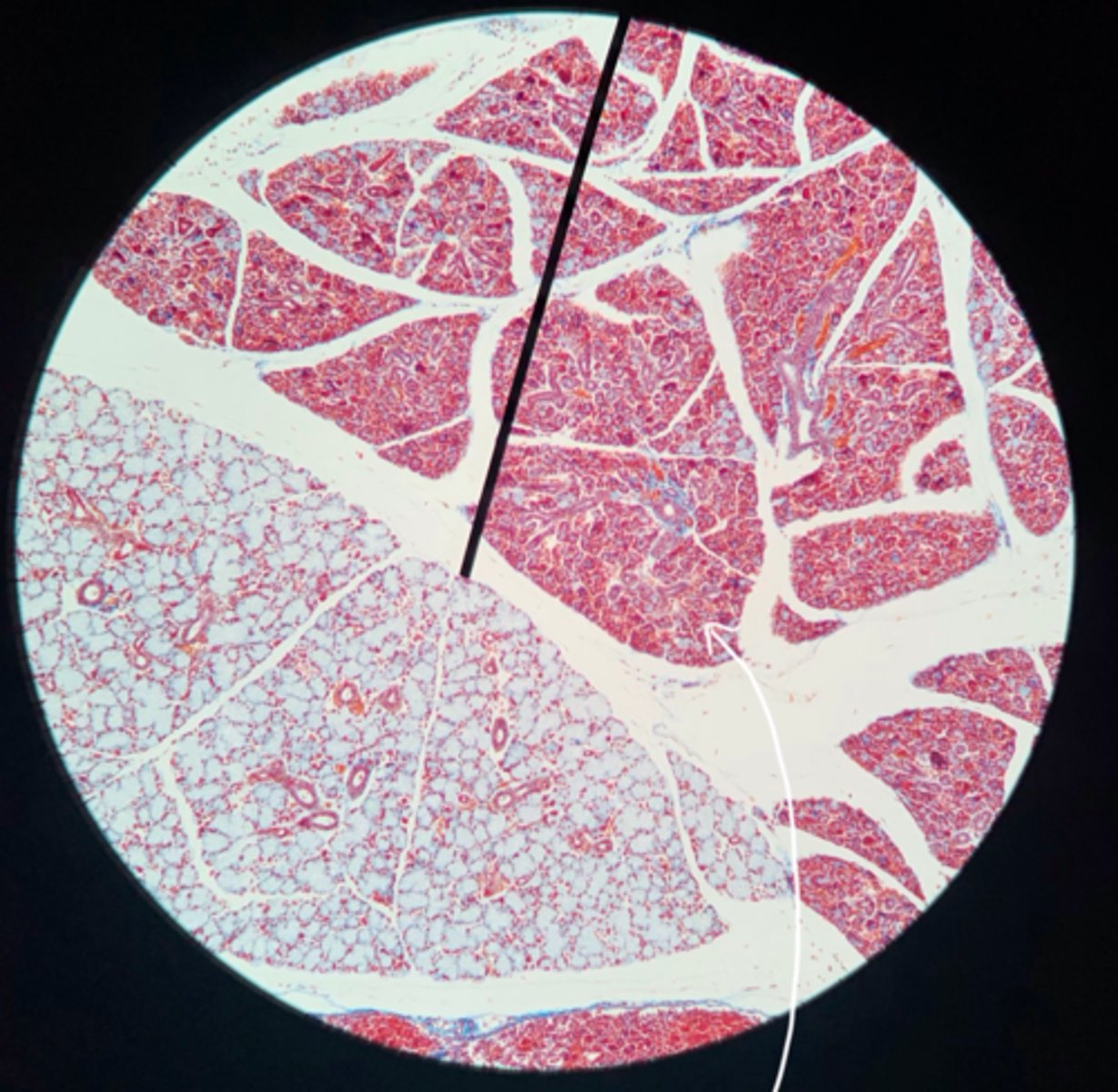 <p>Acini som producerar saliv och ligger i bindvävskapslar</p>