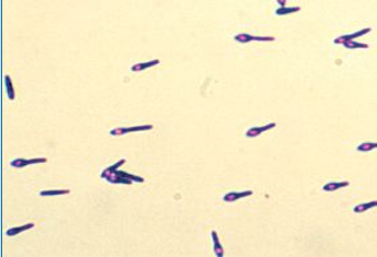 <p>What is shown in the image?</p><p></p><p>a) <em>Clostridium </em></p><p>b) <em>Bacillus </em></p>