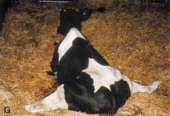 <p>มักจะเกิดหลังคลอดลูก/Pelvic bone หัก → ไม่สามารถหุบขาเข้าด้านใน (adduction)</p>