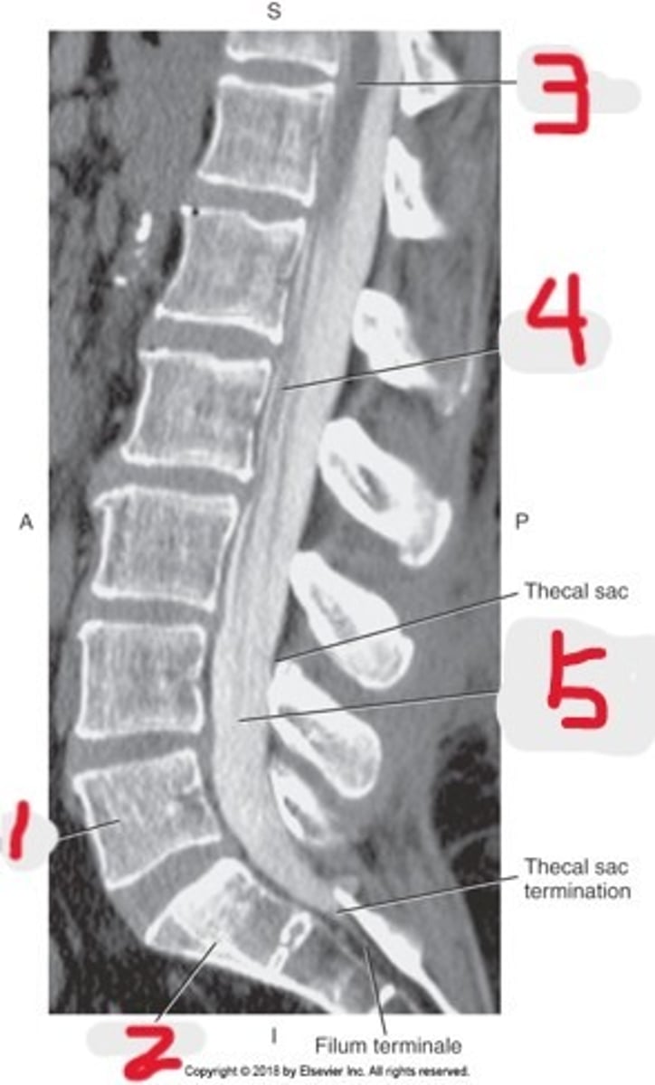 <p>Name all numbered structures</p>