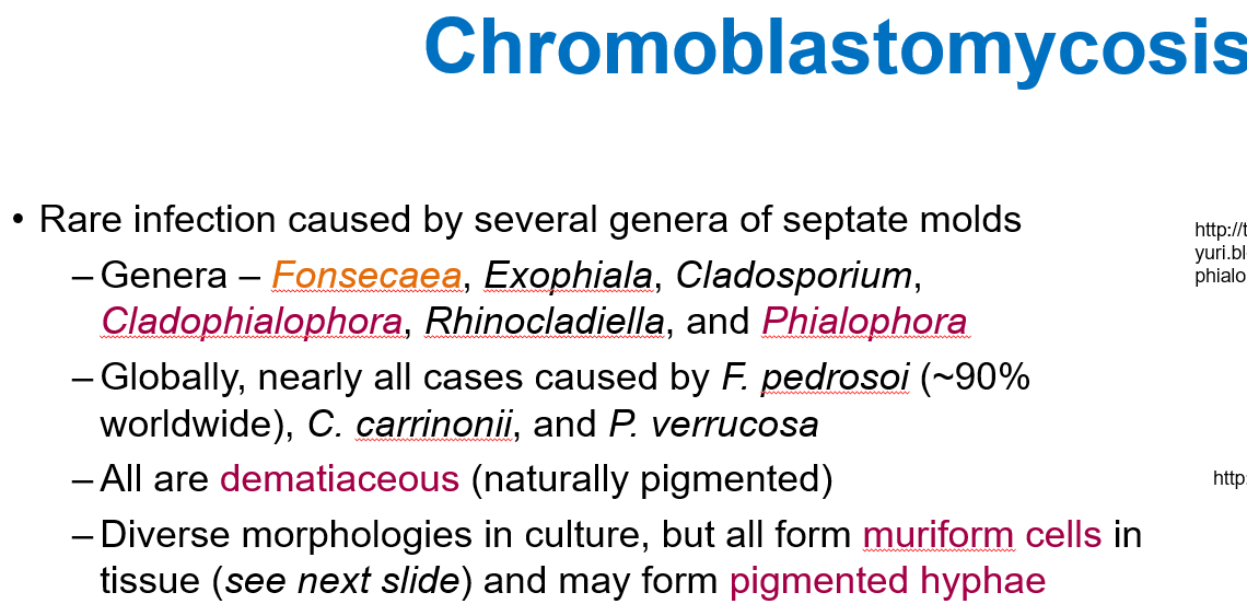 <p>A <strong>rare infection</strong> caused by <strong>several genera of septate molds</strong>, mainly <strong><em>Fonsecaea</em></strong>.</p>