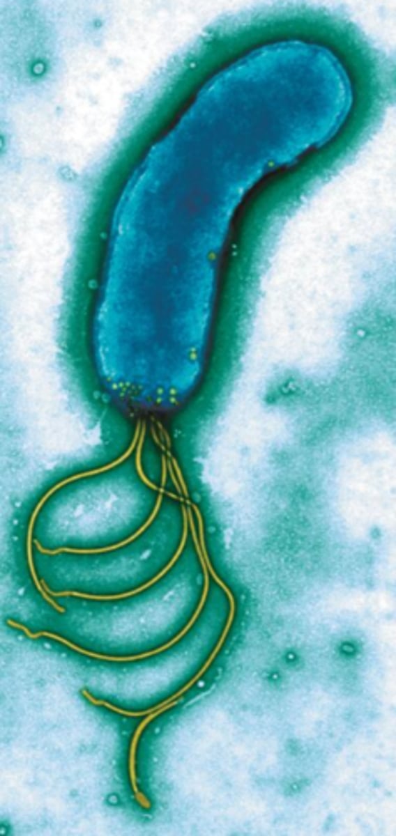 <p>several flagellum on one side</p>