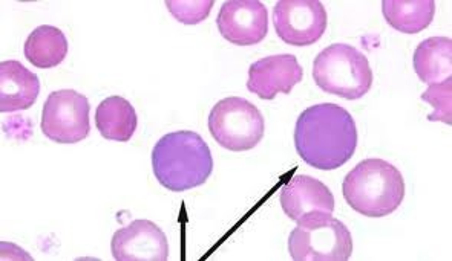 <p>Term for a pale-blue RBC in routine stains, due to RNA content</p>
