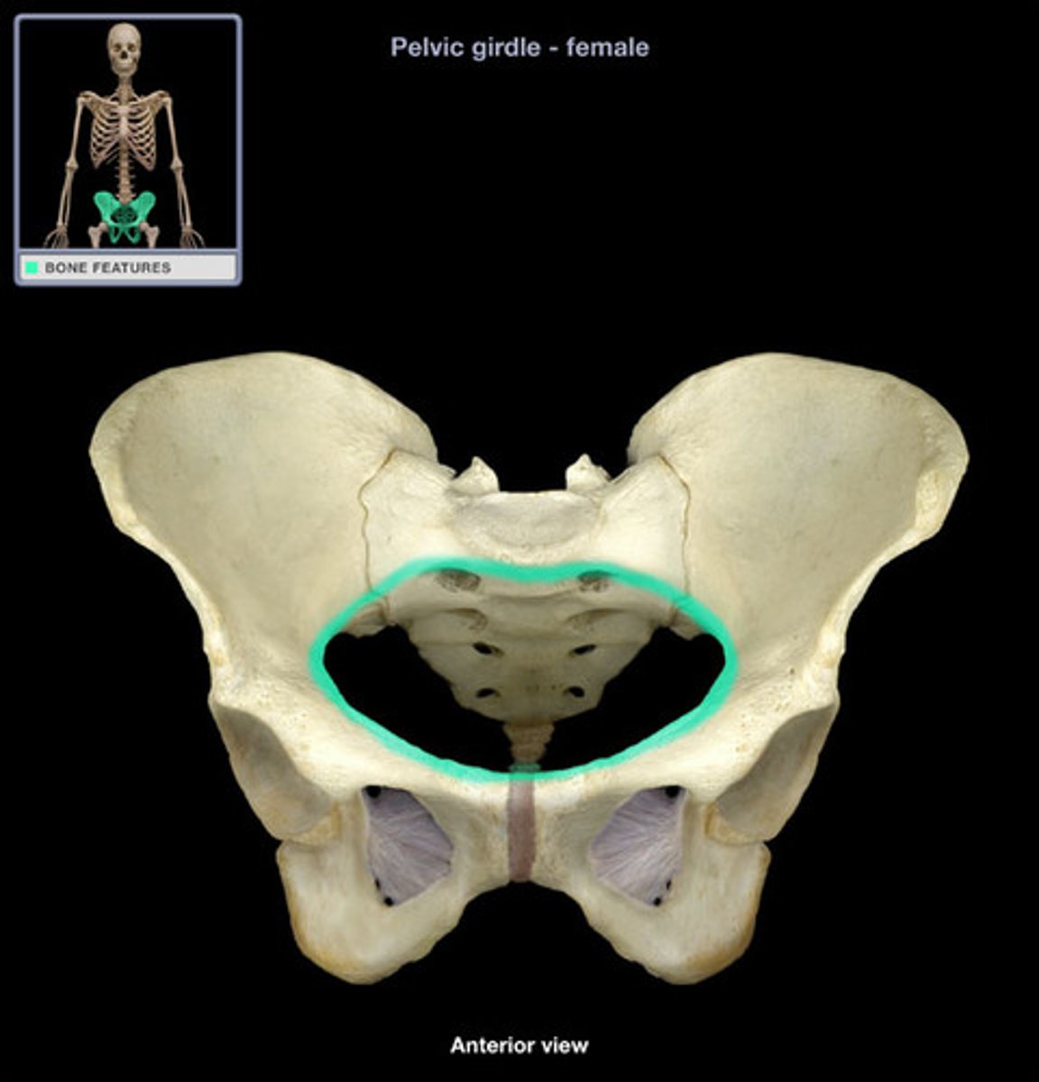 <p>superior pelvic aperture</p>