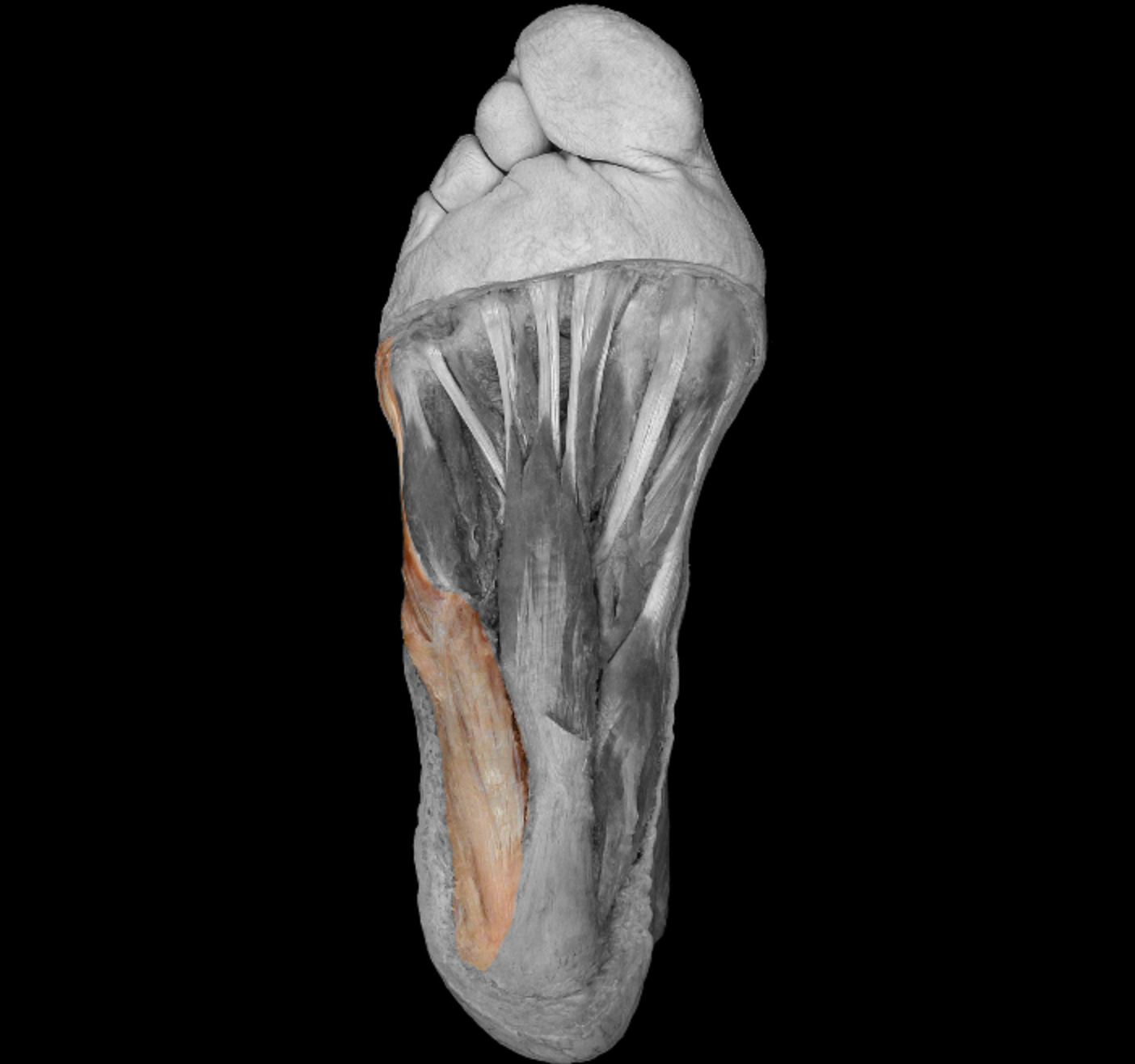 <p>origin: calcaneus, plantar aponeurosis, flexor retinaculum </p><p></p><p>insertion: lateral side of proximal phalanx on little toe </p><p></p><p>action: abduct + flex little toe</p><p></p><p>innervation: lateral plantar nerve </p>