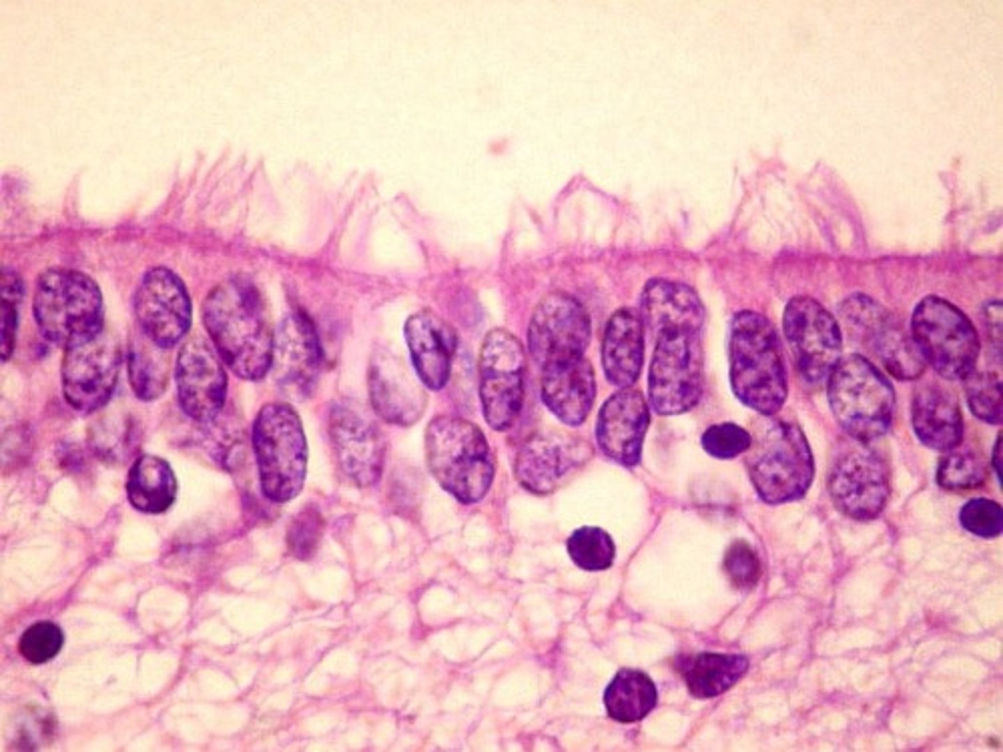 <p>-Type of neuroglia that lines ventricles and covers choroid plexus</p><p>-Produces CSF</p>
