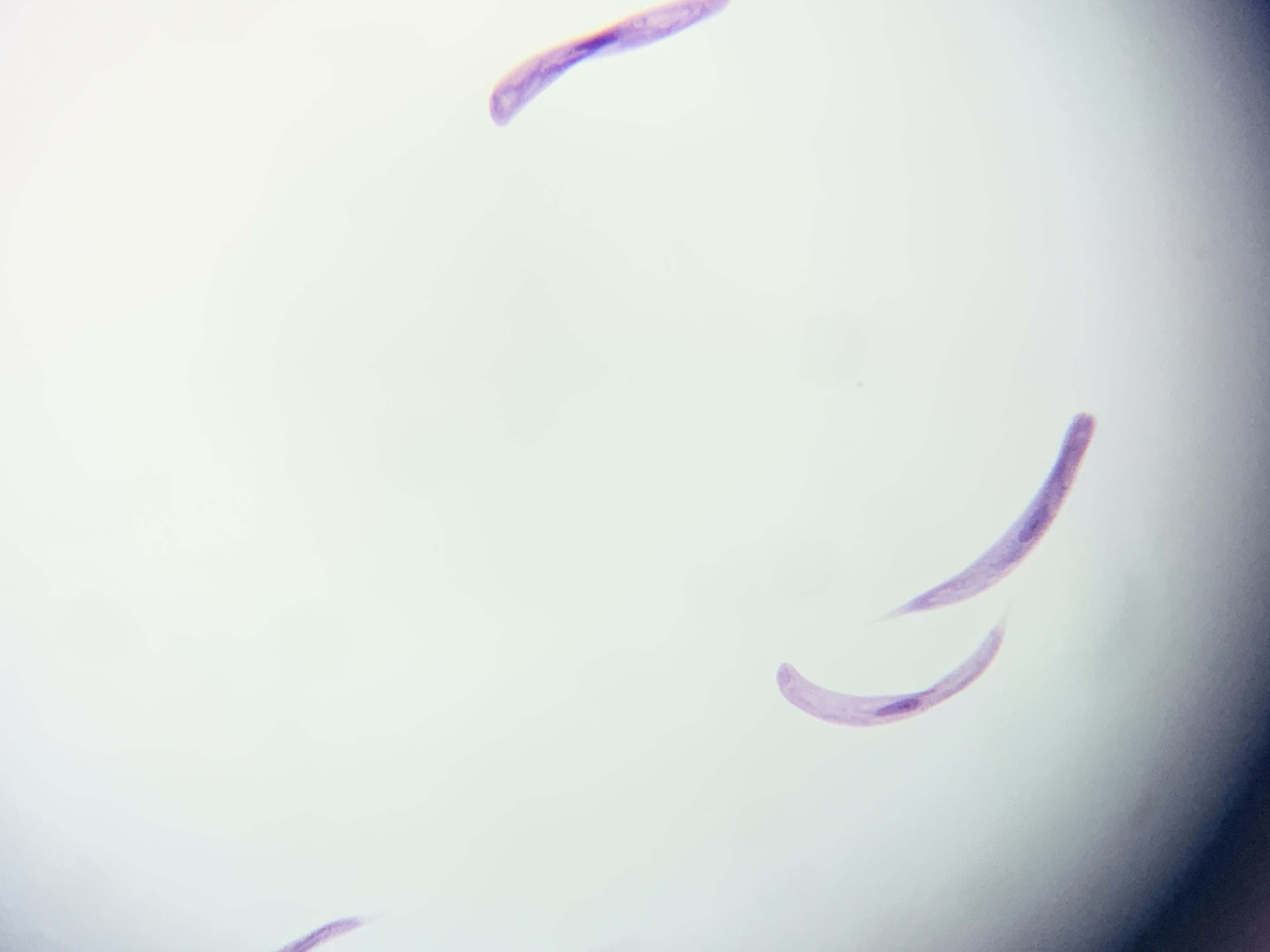 <p><span>Euglena - Euglenophyta</span></p>