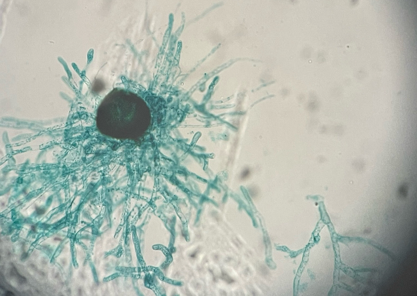 <p>moss protonema</p>