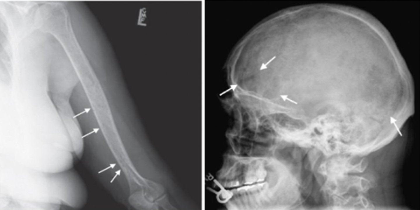 <p>What is the pathology in this image?</p>