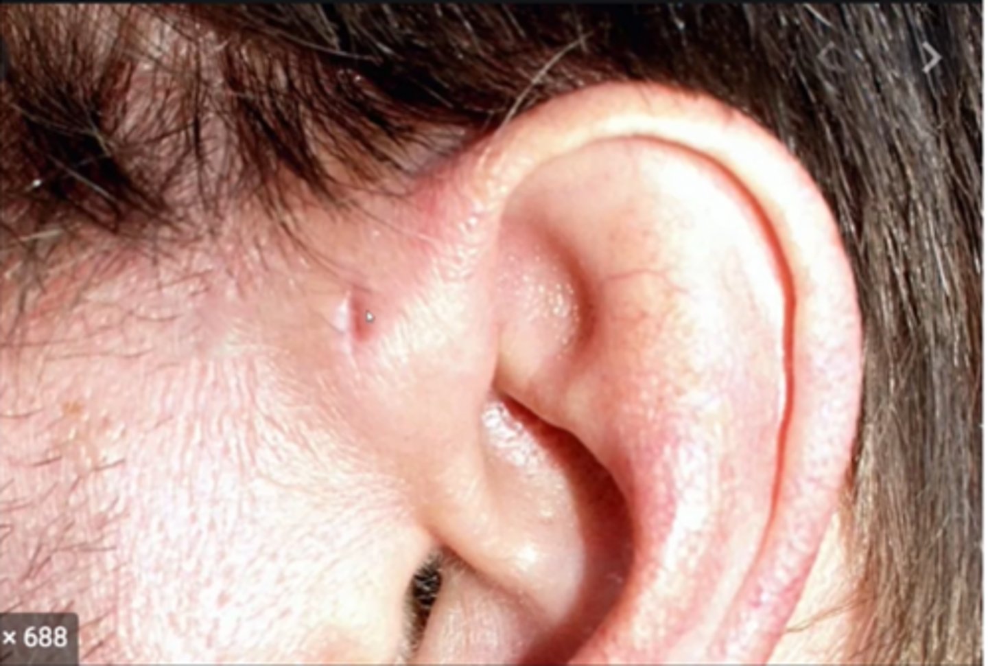 <p>What is this little indent in front of the ear called?</p>