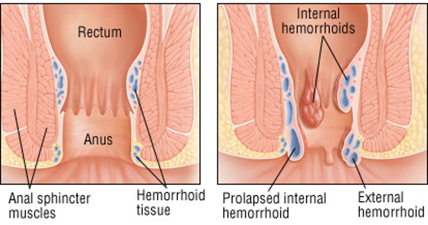 <p>1. superior hemorrhoidal vein</p><p>2. middle hemorrhoidal vein= where most drugs absorbed</p><p>3. inferior hemorrhoidal vein</p><p>- allow for systemic absorption of rectal suppositories</p>