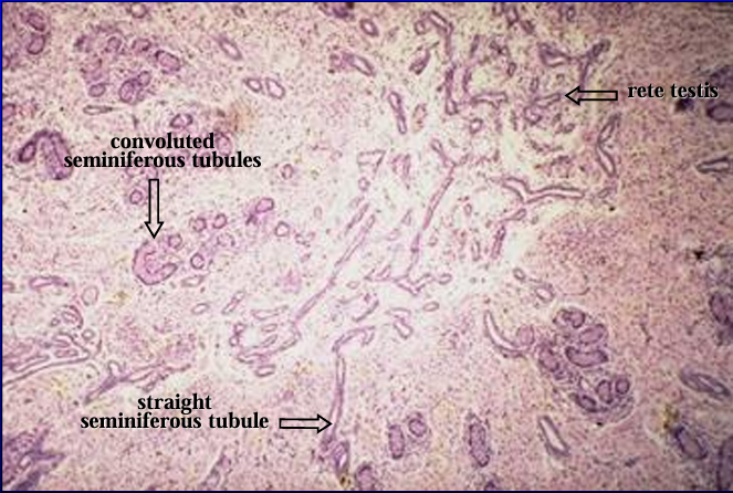<p>Mediastinum testis, 1-day-old pig testis. </p><p>The area of the mediastinum contains straight seminiferous tubules and the rete testis.</p>