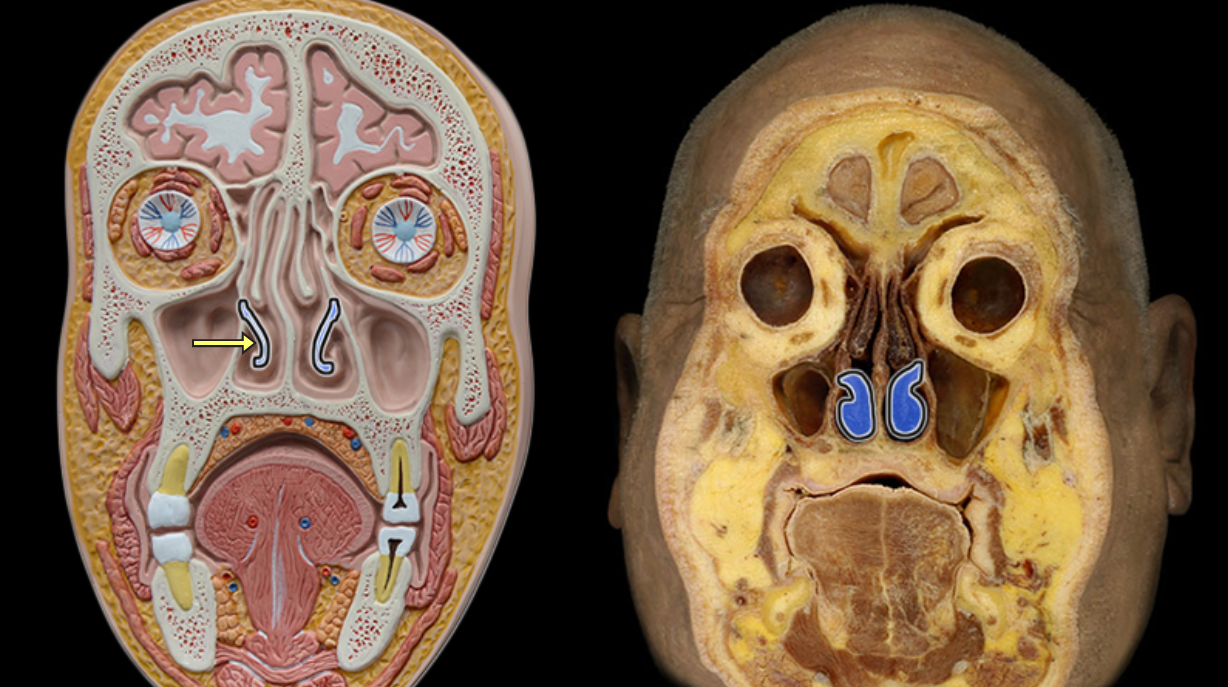 <p>Inferior nasal concha</p>