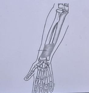 What muscle is shown in the figure below? 