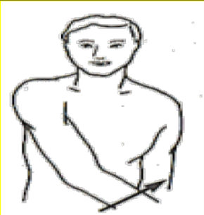 <p>What Movement is occurring?</p>