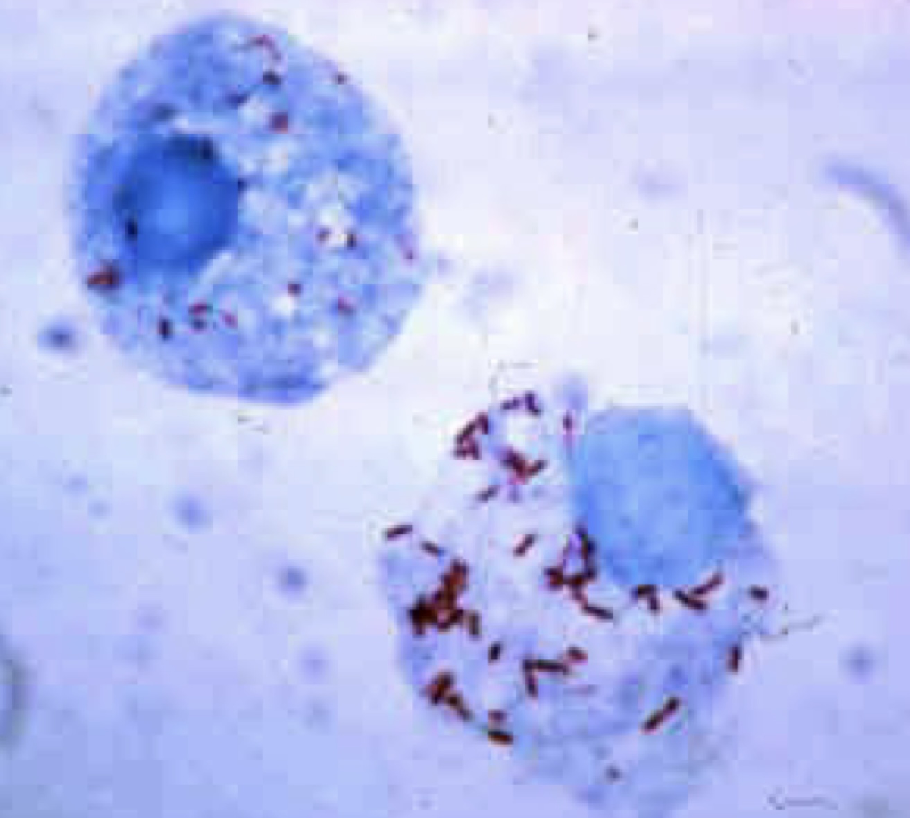 <p>Identify this rickesettial pathogen.</p>