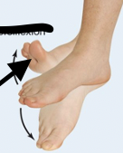 <p>Dorsal fin on back-lifts back up</p>