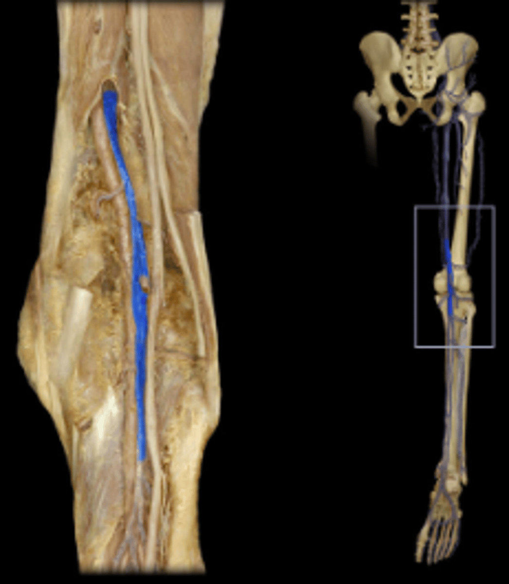<p>Area drained: Knee joint</p><p>Drains into: Femoral vein</p><p>Relationship: Lies in the popliteal fossa. Formed by the union of posterior and anterior tibial veins and passes through adductor magnus muscle to become femoral vein</p>