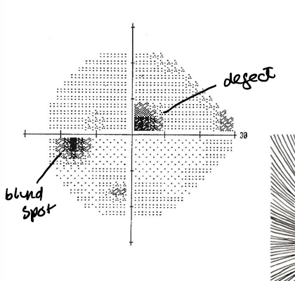 <p>What kind of defect is this</p>
