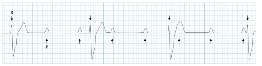 <p>What rhythm is this?</p>