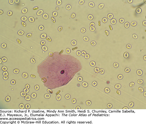 <p>what are most of these cells</p><p></p>