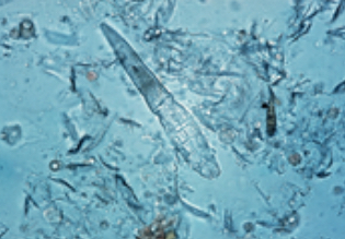 <p>What is the ectoparasite pictured here</p>