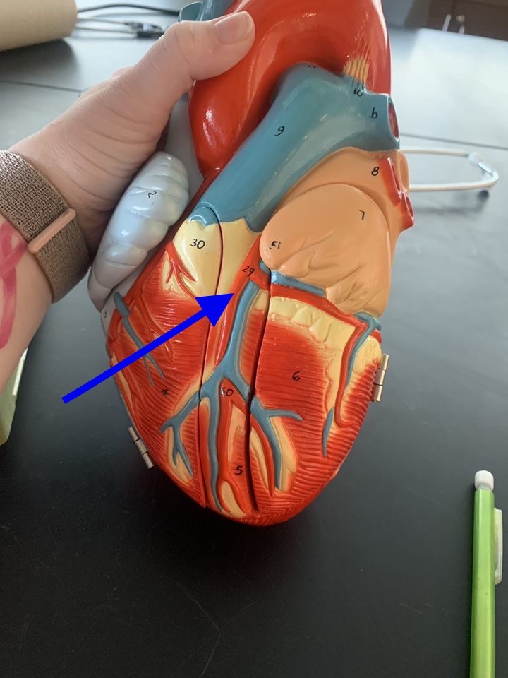 Name the heart structure.