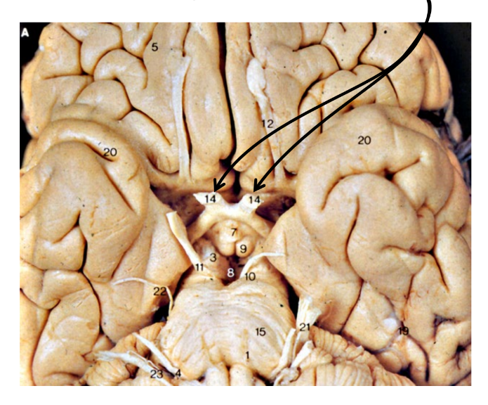 <p>what are the arrows pointing at?</p>