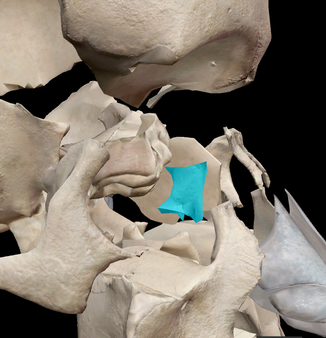 term image