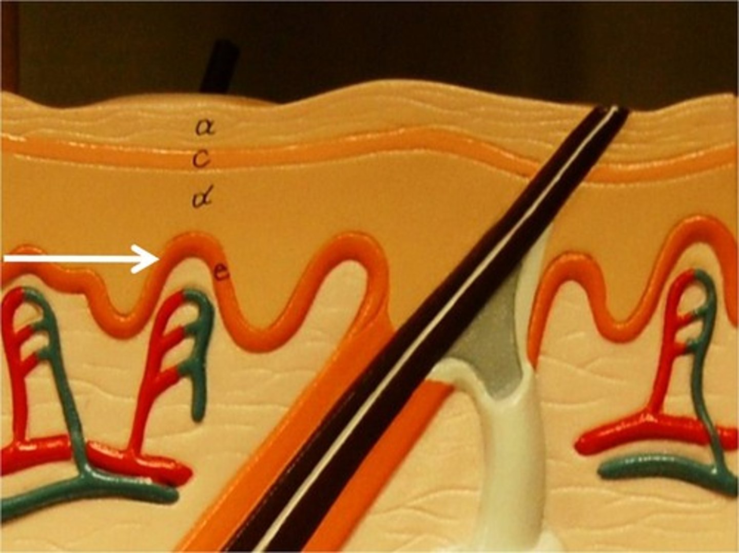 <p>what layer of the epidermis is this</p>