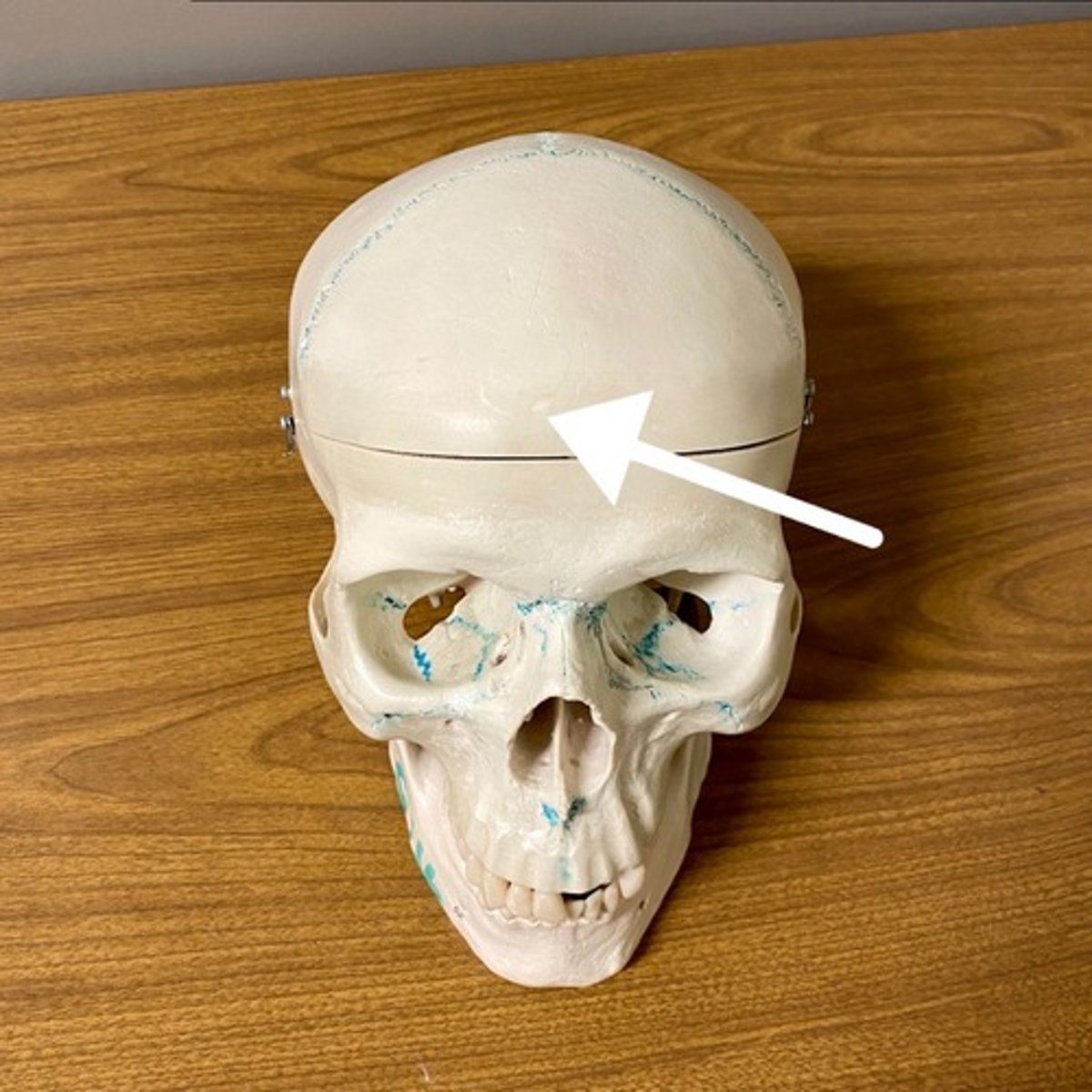 <p>What bone is this?</p>