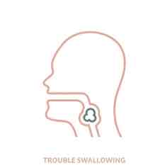 <p>Difficulty swallowing</p>