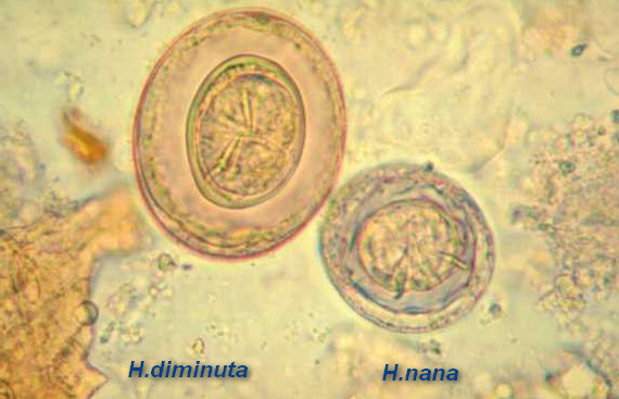 <ul><li><p>    Eggs are detectable in fecal floatation, but shed intermittently​</p></li><li><p>    Proglottids do not float​</p></li></ul><p></p>